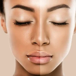 Skin-Brightening-Facial