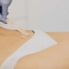 laser-epilation-hair-removal-therapy-5-1